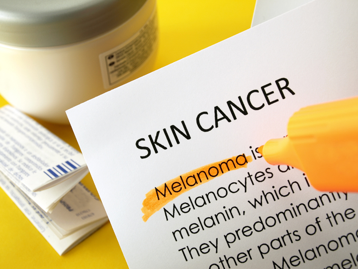 Skin Cancer Blog
